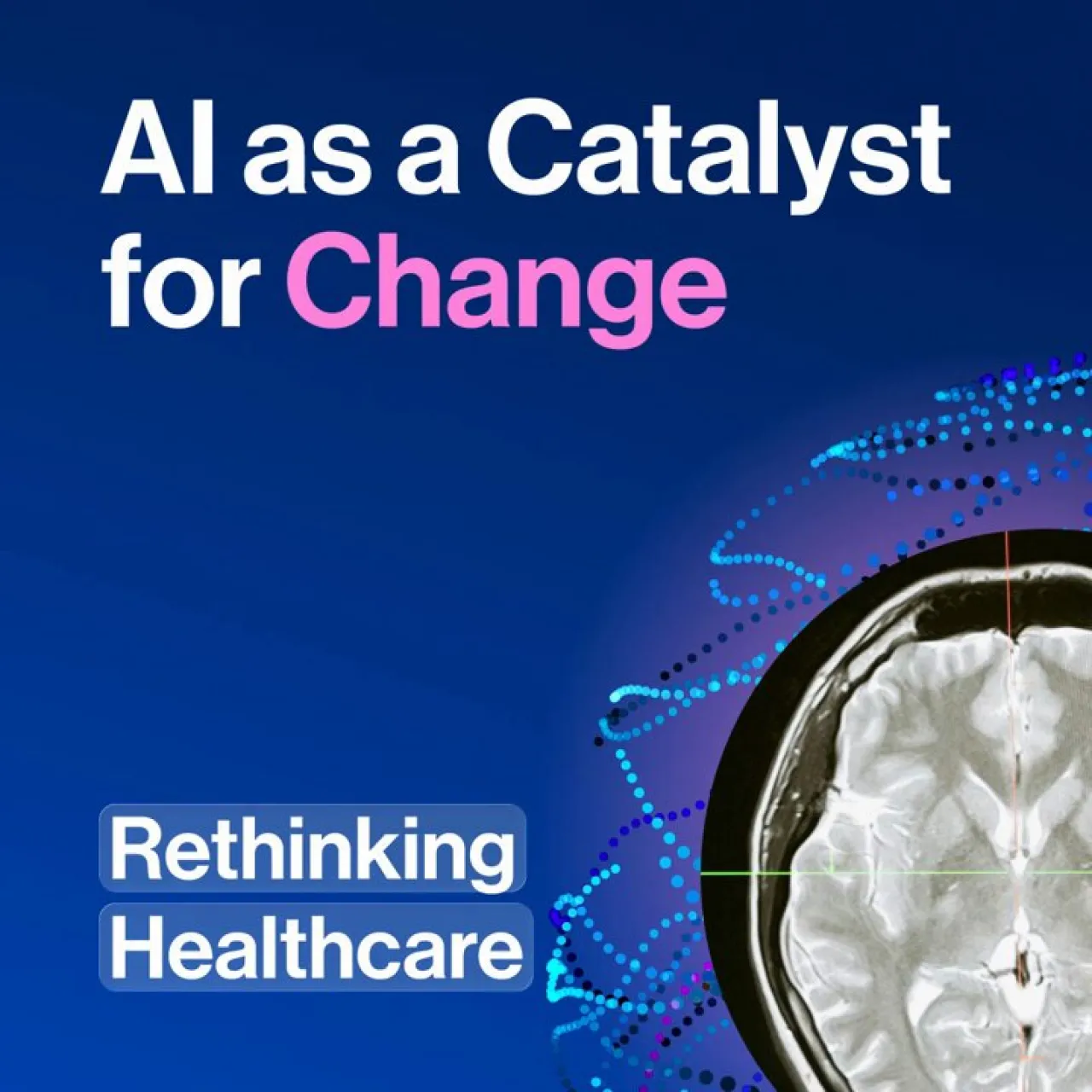 Yapay Zekâ Doktorların Yeni Süper Gücü Olabilir